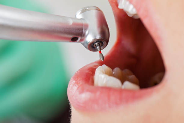 Best Emergency Dental Surgery in Franklinton, NC
